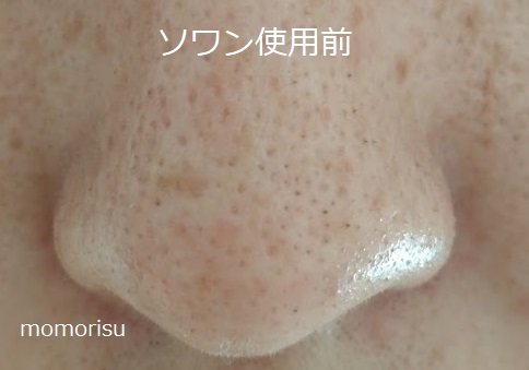 ソワンを使った毛穴の様子