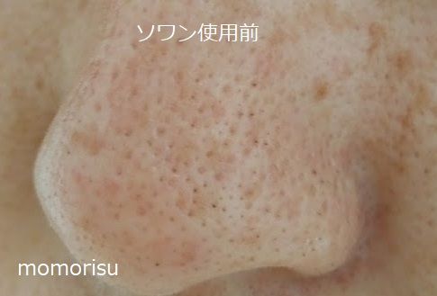 ソワンを使った毛穴の様子左側 使用前