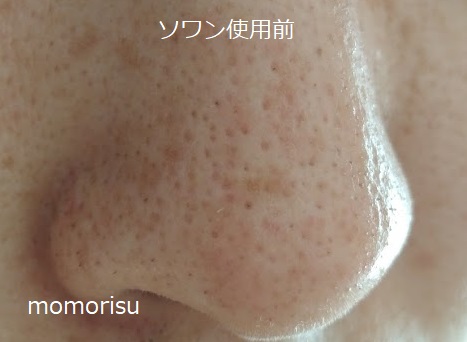 ソワンを使った毛穴の様子右側 使用前