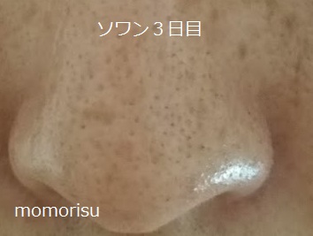 ソワンを使った毛穴の様子3日目