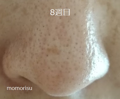 鼻の黒ずみ毛穴8週目の様子