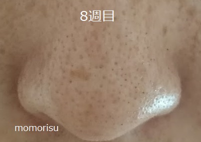 鼻の毛穴8週目の画像